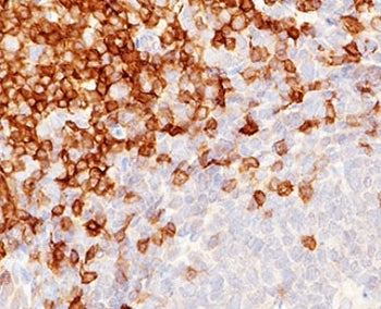 IHC testing of FFPE human tonsil stained with CD5 antibody (clone CLDA5-1). Staining of formalin-fix