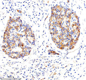 Immunohistochemical staining of LRG1 using anti-LRG1 antibody. LRG1 was detected in a paraffin-embed