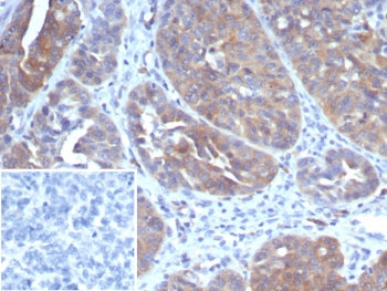 GCLM Antibody / Glutamate-Cysteine Ligase Regulatory Subunit