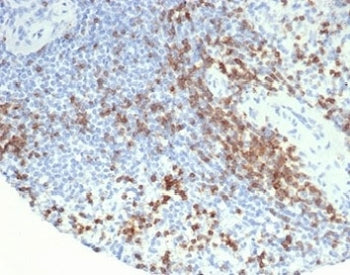 IHC staining of FFPE human spleen tissue with CD2 antibody (clone LFA2/7104). HIER: boil tissue sect