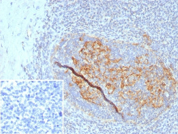 IHC staining of FFPE human tonsil tissue with CD35 antibody (clone CR1/8223R). Inset: PBS used in pl