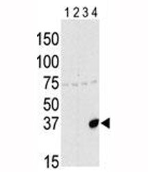 Western blot testing of Aurora-C antibody and lysate of 293 cells expressing 1) Flag tag, 2) Flag-ta