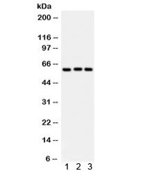 Western blot testing of 1) rat liver, 2) human placenta, 3) A549 lysate with Heparanase 1 antibody. 