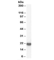 Western blot testing of human brain lysate with Peroxiredoxin 2 antibody at 1ug/ml. Predicted molecu