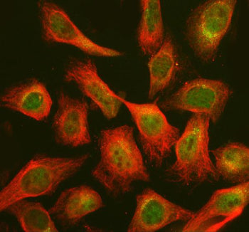 Immunofluorescent staining of CHP2 using anti-CHP2 antibody (green) and anti-Beta Tubulin antibody (