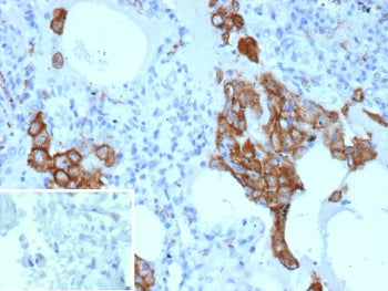 IHC staining of FFPE human lung tissue with MRC1 antibody (clone MRC1/9454). Inset: PBS used in plac