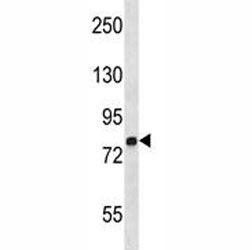 MMP9 antibody western blot analysis in NCI-H292 lysate. Predicted molecular weight: 92/67-80 kDa (pr
