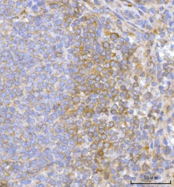 Hamartin Antibody / TSC1