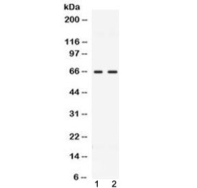 CCDC6 Antibody