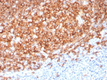 IHC staining of FFPE human tonsil tissue with CD20 antibody (clone MS4A1/3410). HIER: boil tissue se