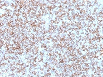HLA-DP + HLA-DR Antibody (MHC II)