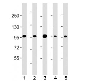 Western blot testing of Beta Catenin antibody at 1:4000: Lane 1) human HEK293, 2) (h) HeLa, 3) monke