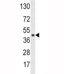 SKP2 Antibody
