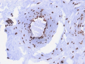 dsDNA Antibody / Double Stranded DNA