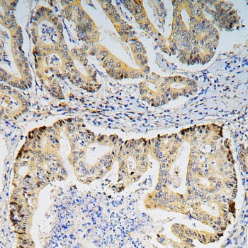 BRG1 Antibody / SMARCA4