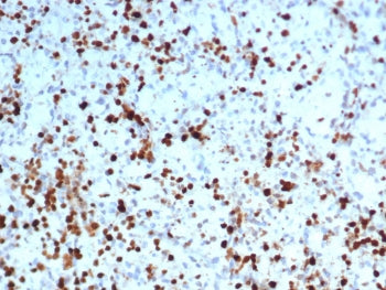 IHC staining of FFPE human spleen tissue with S100A4 antibody (clone S100A4/7096). HIER: boil tissue