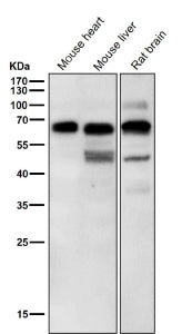 All lanes use the Phospho-p70 S6 Kinase beta (Ser371) antibody at 1:6K dilution for 1 hour at room t