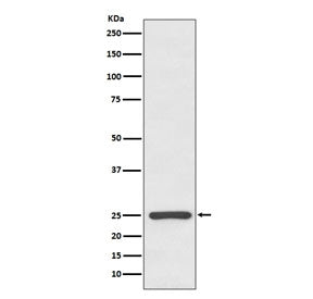 Western blot testing of human serum lysate with Kappa antibody. Expected molecular weight: 23-25 kDa