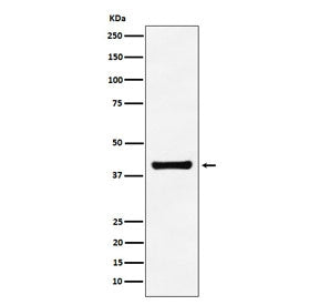 Western blot testing of human A549 cell lysate with ALDOA antibody. Predicted molecular weight ~40 k