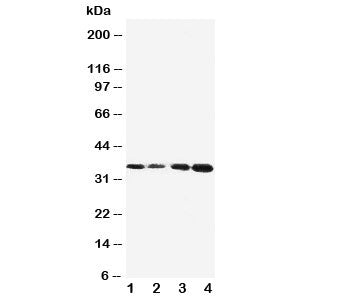Western blot testing of Protein C antibody and Lane 1: Jurkat; 2: CEM; 3: SMMC-7721; 4: HeLa cell ly