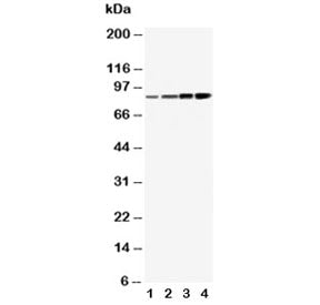 Western blot testing of PI3K antibody and human lysates from 1) MCF-7, 2) HeLa, 3) COLO-320 and 4) S