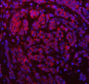SDF2L1 Antibody / SDF2-like protein 1