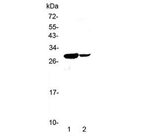 Western blot testing of 1) mouse spleen and 2) mouse thymus lysate with IL17C antibody at 0.5ug/ml. 
