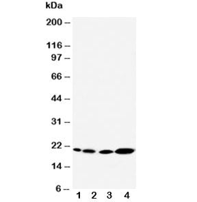Western blot testing of Caveolin-2 antibody and Lane 1: rat heart; 2: rat lung; 3: HeLa; 4: A431 cel
