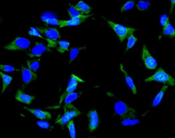 Immunofluorescent staining of FFPE human U-2 OS cells with Inhibin alpha antibody (green) and DAPI n