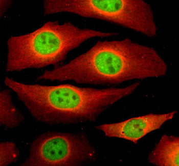 Immunofluorescent staining of NCAPG using anti-NCAPG antibody (green) and anti-Beta Tubulin antibody