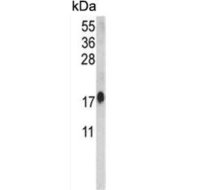 Western blot testing of human HeLa cell lysate with CALM1 antibody. Predicted molecular weight ~17 k