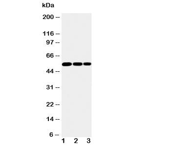 Western blot testing of IKK gamma antibody and Lane 1: mouse liver; 2: mouse brain; 3: mouse ovary t