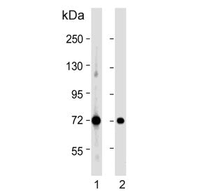 Western blot testing of human 1) LNCaP and 2) MCF7 cell lysate with Pyruvate Dehydrogenase E2 antibo