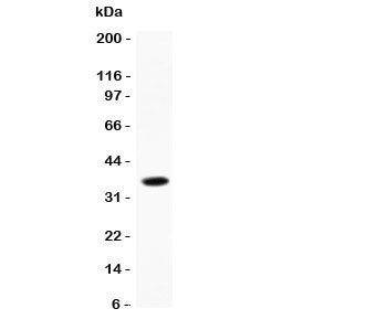 CCL13 Antibody (SCYL1)