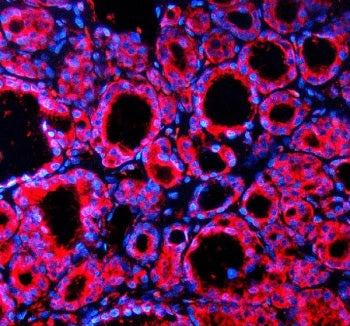 Immunofluorescent staining of SPOCK1 using anti-SPOCK1 antibody (red). SPOCK1 was detected in a para