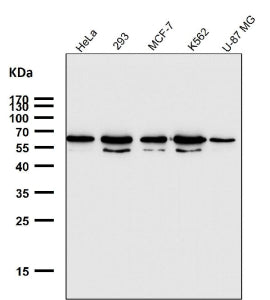 Western blot testing of human samples using the GTF2E1 antibody at 1:1000 dilution for 1 hour at roo
