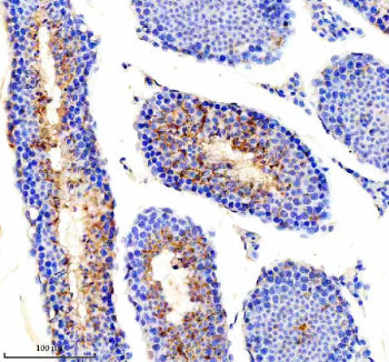 Immunohistochemical staining of PICK1 using anti-PICK1 antibody. PICK1 was detected in a paraffin-em