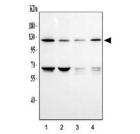 Western blot testing of human 1) HeLa, 2) K562, 3) A549 and 4) Caco-2 cell lysate with DDR1 antibody
