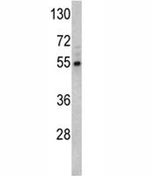 Fascin Antibody