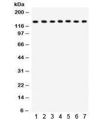 Western blot testing of 1) rat lung, 2) mouse lung, 3) HeLa, 4) MM231, 5) COLO320, 6) A549 and 7) mo