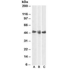 Western blot testing of human spleen [A], tonsil [B] and thymus [C] lysates with CD27 antibody at 0.