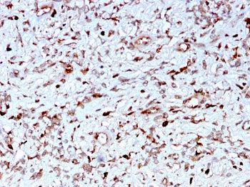 C1QA Antibody / Complement C1q A-Chain