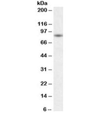 Western blot testing of human skeletal muscle lysate with BAG3 antibody at 0.1ug/ml. Predicted molec