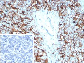 Mesothelin Antibody / MSLN