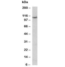 Western blot testing of thyroid gland lysate with Thyroid peroxidase antibody at 0.1ug/ml. Predicted