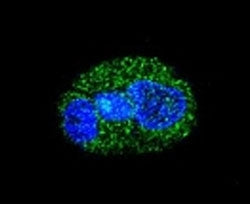 HNF1A Antibody