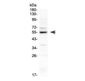 Western blot testing of rat lung lysate with EPOR antibody at 0.5ug/ml. Predicted molecular weight ~