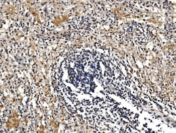 IHC staining of FFPE human splenic rupture tissue with GFPT1 antibody. HIER: boil tissue sections in