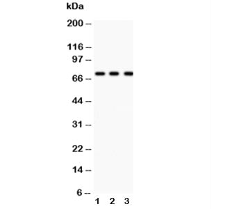 Western blot testing of p73 antibody and Lane 1: COLO320; 2: MCF-7; 3: HeLa lysate