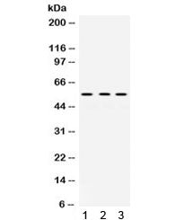Western blot testing of human 1) SMMC, 2) 22RV1 and 3) MCF7 cell lysate with MMP-1 antibody. Expecte